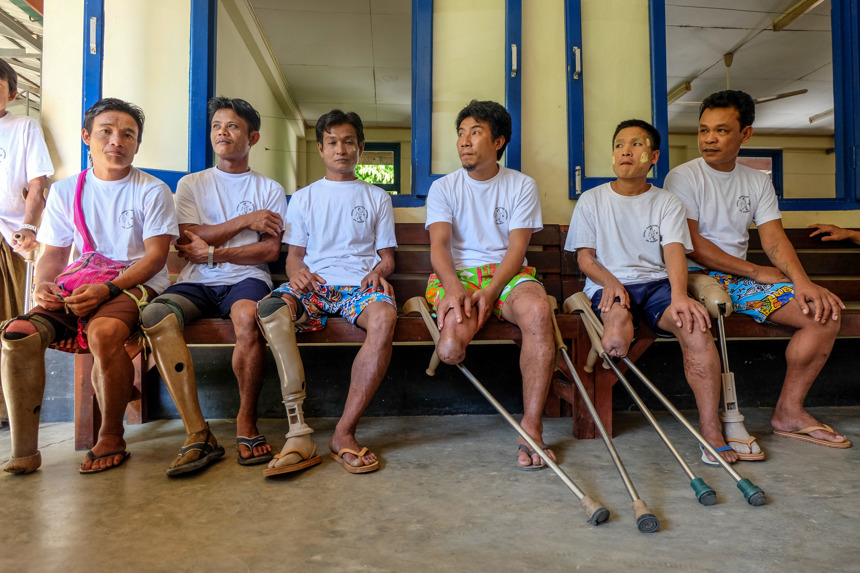 Group of men with explosives injuries